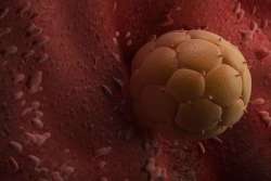 Embryo Dividing